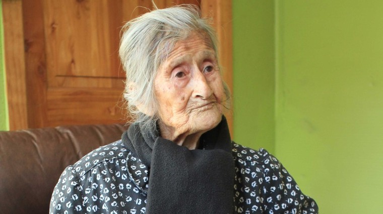 60 năm thai nhi nằm trong bụng bà cụ 91 tuổi mà không biết ảnh 1