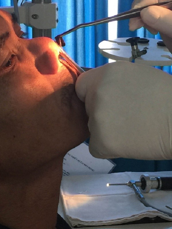 Rùng mình đỉa 'làm tổ' trong hốc mũi người đàn ông ở Ninh Thuận ảnh 2