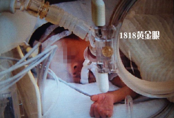 Bé trai sống sót kỳ diệu sau 15 giờ trong tủ đông lạnh ảnh 1