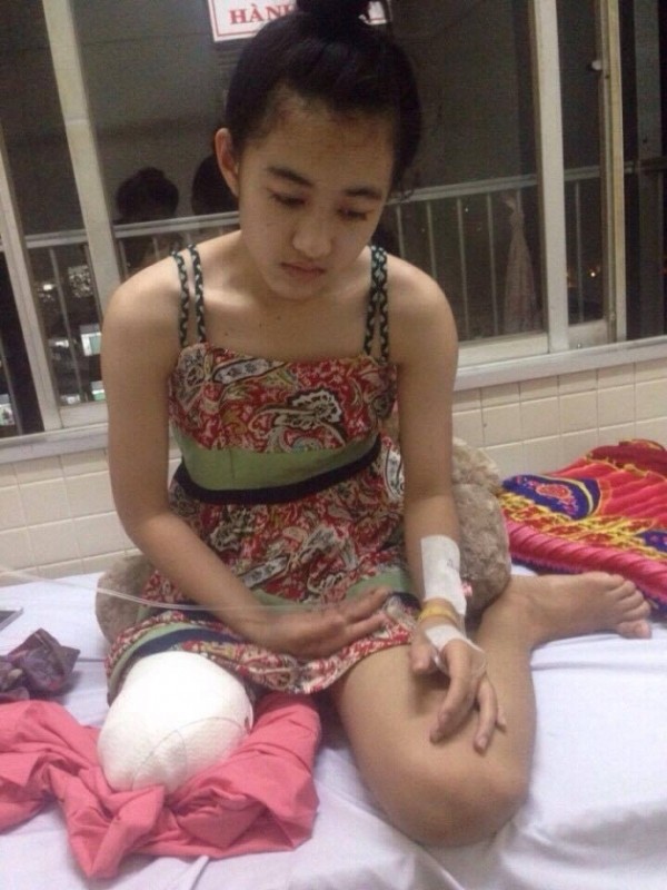 Ai phải bồi thường 1 tỷ đồng cho nữ sinh mất chân? ảnh 1