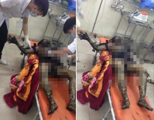 Bố mẹ như ngọn đuốc sống trong phòng, con ú ớ kêu cứu ảnh 2