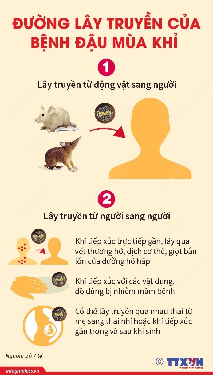 Bệnh Đậu mùa Khỉ: Triệu chứng và các biện pháp phòng bệnh ảnh 2