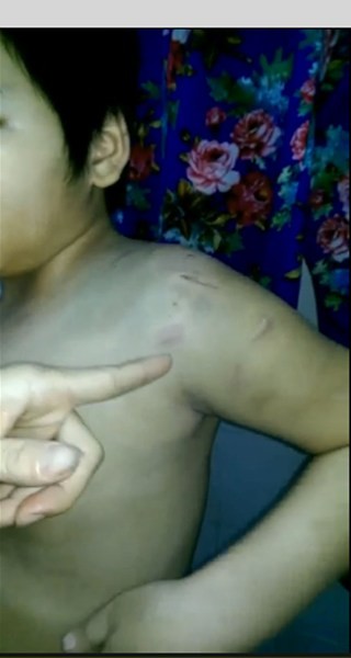 Bé trai 9 tuổi bị mẹ và dì hành hạ đến nhập viện vì 'đọc kinh không thuộc' ảnh 3