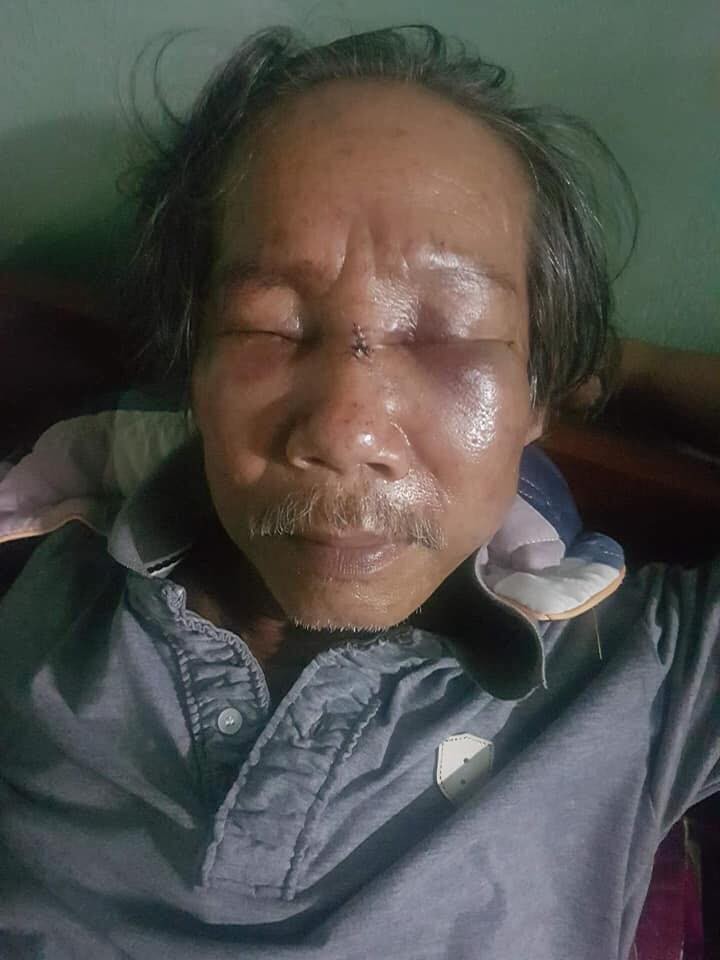 Bảo vệ chung cư SaiGon Metro Park hành hung người già gây phẫn nộ mạng xã hội ảnh 1