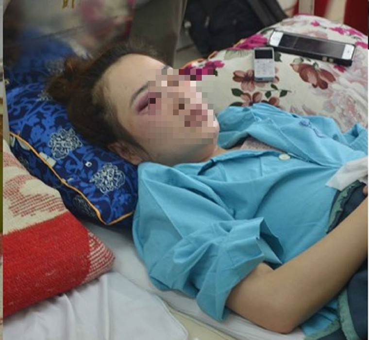 Đánh cô gái nhập viện rồi xưng người nhà Phó Giám đốc công an ảnh 1