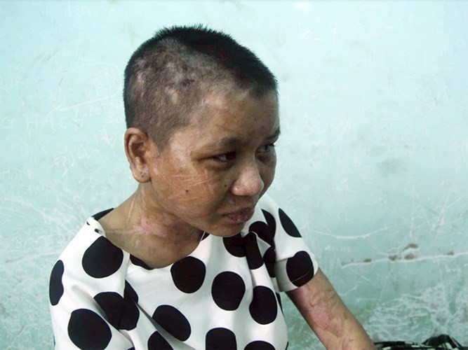 Lộ thêm những đòn tra tấn man rợ của bà chủ mất nhân tính ở Gia Lai ảnh 1