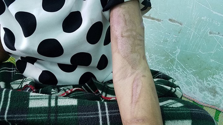 Lộ thêm những đòn tra tấn man rợ của bà chủ mất nhân tính ở Gia Lai ảnh 2