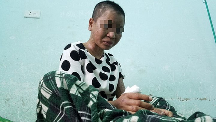 Lộ thêm những đòn tra tấn man rợ của bà chủ mất nhân tính ở Gia Lai ảnh 3