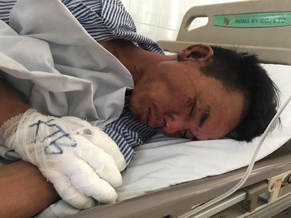 Con rể phóng hỏa, truy sát cả nhà vợ cũ ảnh 1