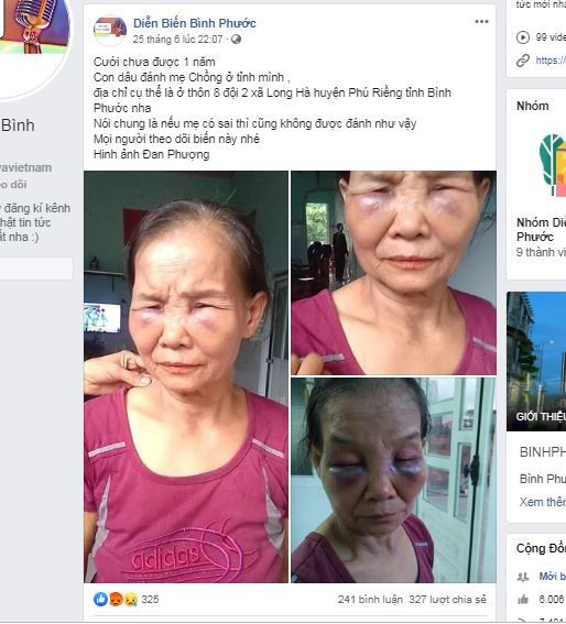 Vụ con dâu đánh mẹ chồng bầm tím mắt: Xin lỗi mẹ chồng tại công an xã ảnh 2