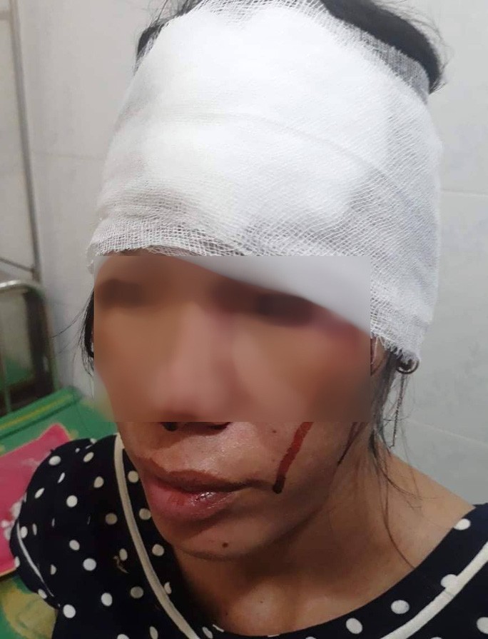 Người phụ nữ khuyết tật đang mang thai bị đánh nhập viện ảnh 1