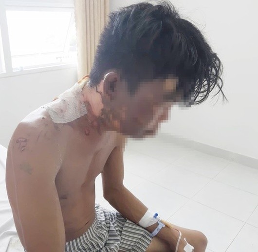 Lời trần tình bất ngờ của cha mẹ ruột nam thanh niên 'tố' bị chị gái tạt nước sôi ảnh 1