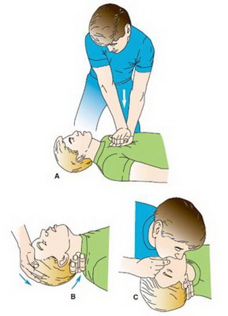 Đề phòng đột tử do truỵ tim ảnh 1