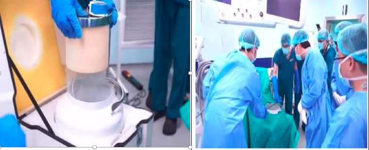 Vinmec áp dụng thành công kỹ thuật ghép xương tự thân cho bệnh nhân ung thư xương ảnh 2