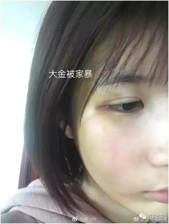 'Hotboy Cung đình' bị tố lăng nhăng, đánh đập người yêu cũ ảnh 3