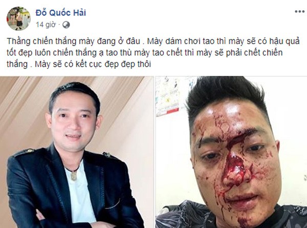 Chiến Thắng phủ nhận chuyện đánh khán giả ảnh 1