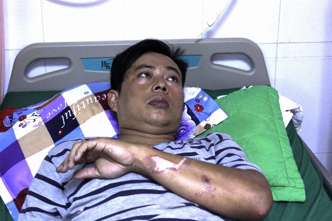 Kịp thời cứu sống người đàn ông bị điện giật ngưng tim ảnh 1