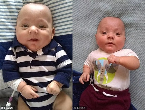 Sinh non nặng vẻn vẹn 450 gam và 'không có ruột', cậu bé vẫn sống sót kỳ diệu ảnh 2