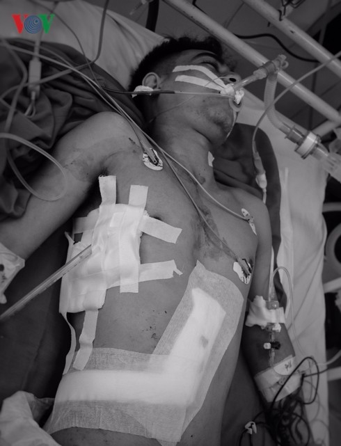 Cứu sống kịp thời nam thanh niên bị đâm thủng tim, gan ảnh 1