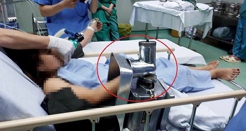 Nữ nhân viên bị máy xay thịt cuốn nát bàn tay ảnh 1