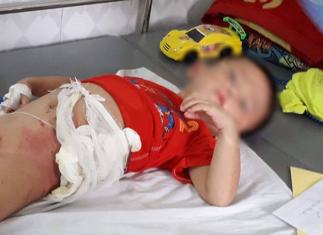 Cậu ruột ném cháu trai 4 tuổi vào đống lửa vì giành ăn quả dưa chuột ảnh 1