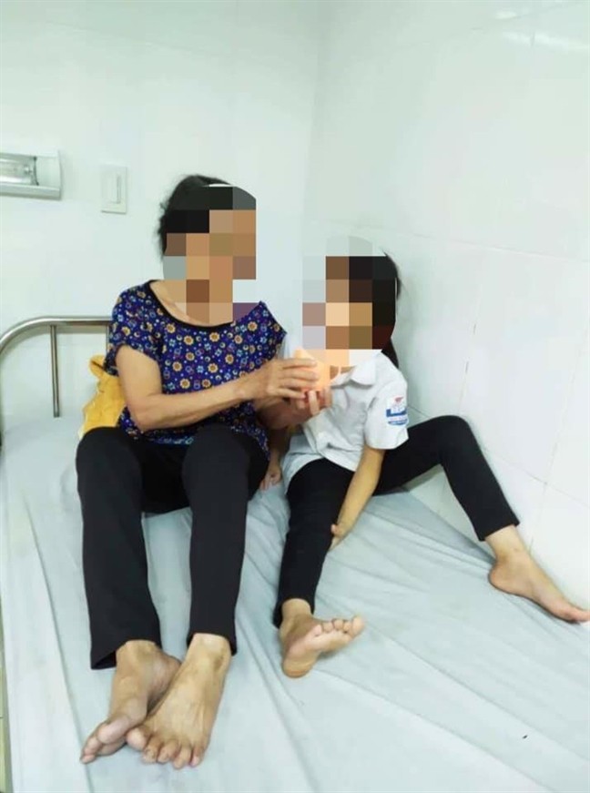 Cho trâu ăn, bé gái 9 tuổi bị húc gãy xương hàm ảnh 1