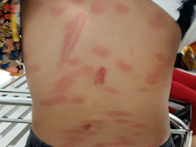 Tạm giữ hình sự người cha đánh con gái 6 tuổi bằng khúc sắt ảnh 1