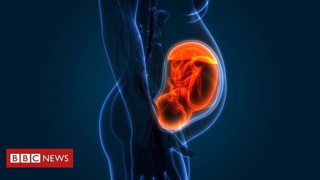 Hạt ô nhiễm không khí - mối nguy khủng khiếp với mầm non tương lai ảnh 2