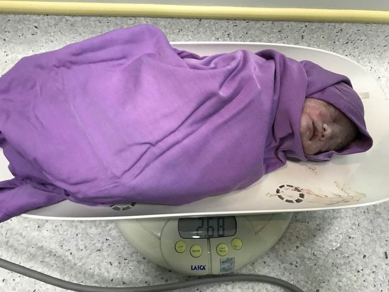 Thai phụ mắc u gan: Bác sỹ Quảng Ninh mổ thai và gan cùng lúc, cứu thành công 2 mẹ con ảnh 2