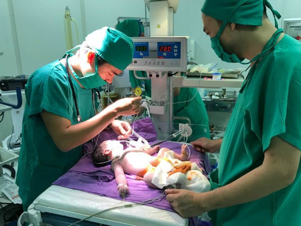 Em bé chào đời với khối thoát vị rốn ảnh 1