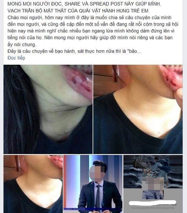 Vụ 'MC truyền hình bị tố bạo hành em vợ': Cơ quan chức năng vào cuộc ảnh 1