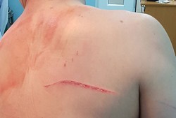 Vợ cũ thuê giang hồ 'dằn mặt' bác sĩ Chiêm Quốc Thái giá một tỷ đồng ảnh 1