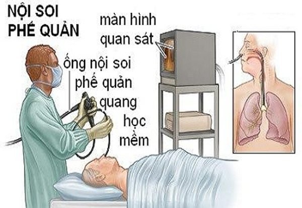 BV Bạch Mai công bố nguyên nhân bệnh nhân tử vong sau nội soi ảnh 1