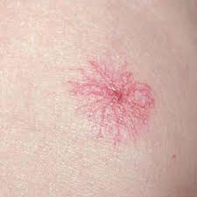 Những dấu hiệu bệnh nguy hiểm từ gan không thể ngờ ảnh 1