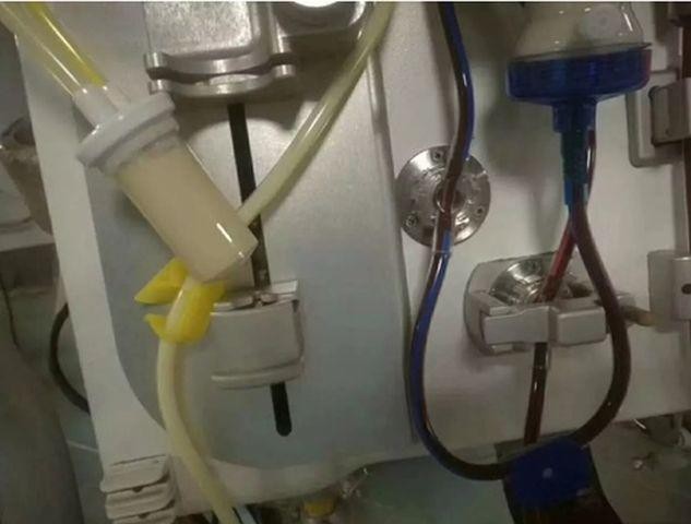 Bác sĩ giật mình khi máu bệnh nhân có lớp váng như mỡ, do ăn những món ai cũng thích ảnh 4