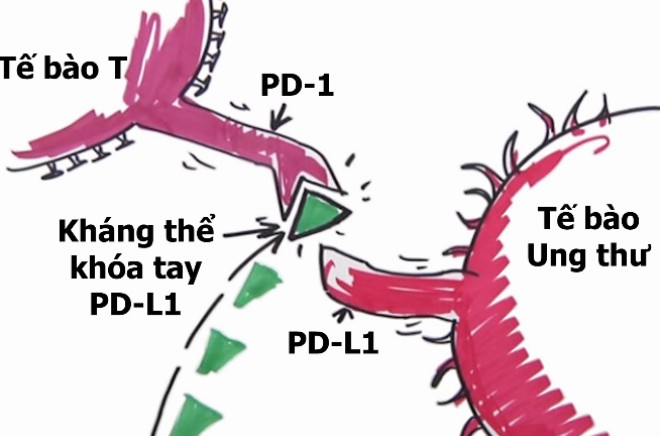 Bác sĩ Việt Nam: 'Liệu pháp miễn dịch là tiến bộ đột phá trong chữa ung thư' ảnh 1