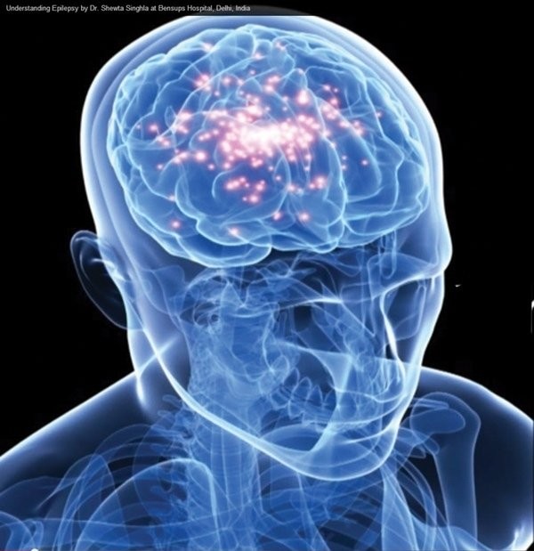 5 căn bệnh nan y bị hiểu lầm tai hại ảnh 6