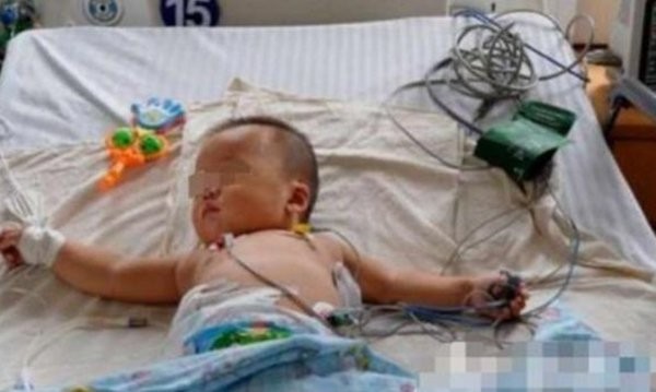 Em bé 1 tuổi bị suy thận do thói quen nấu nướng sai lầm của mẹ ảnh 1