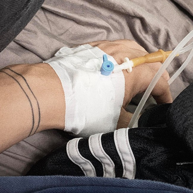 Căn bệnh nguy hiểm khiến nam ca sĩ trẻ người Việt suýt liệt nửa người ảnh 2