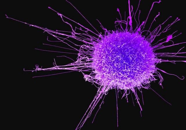 Gen sinh ung thư mới được phát hiện ảnh 1