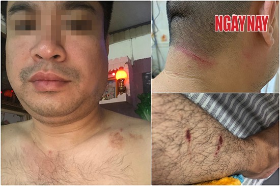 Quận 10: Người dân tố bị Trưởng công an phường hành hung vì phơi nắng 2 con gà ảnh 1