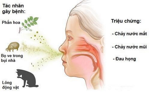 Đối phó với các bệnh dị ứng mùa xuân ảnh 1