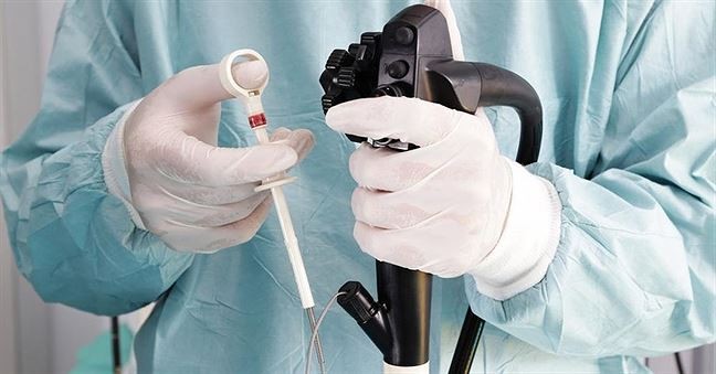 Nguy cơ mắc bệnh viêm gan, HIV khi đi nội soi ảnh 1