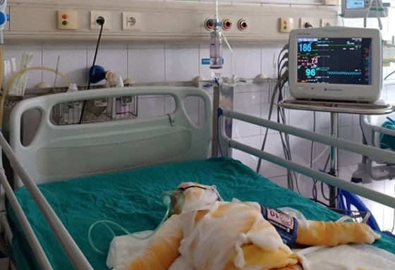 Vụ dạy 'kỹ năng sống' khiến 3 trẻ bỏng nặng: Công an làm rõ trách nhiệm những người liên quan ảnh 1