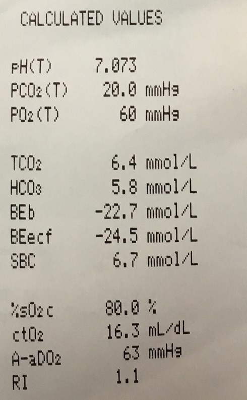 Uống rượu 5 ngày liên tục, nam bệnh nhân 33 tuổi suýt chết phải nhập viện cấp cứu ảnh 1