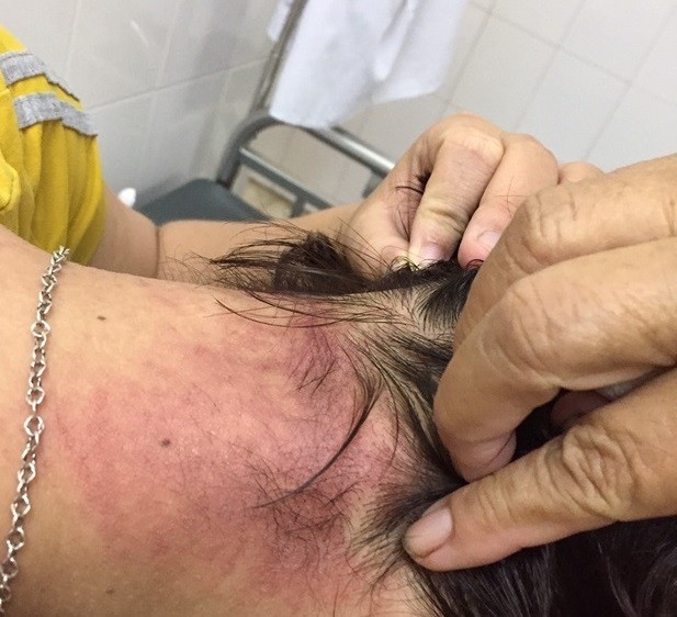 Kiến ba khoang bay vào bệnh viện Sài Gòn tấn công bệnh nhân ảnh 1