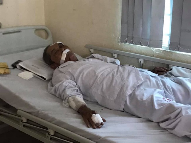 Lời kể bàng hoàng của cụ ông 80 tuổi bị gã xe ôm đánh dã man vì tưởng tranh giành địa bàn ảnh 1