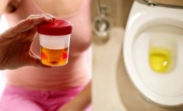 3 bộ phận trên cơ thể “bốc mùi”, chứng tỏ gan đang kêu cứu, cần phải kiểm tra kịp ảnh 3