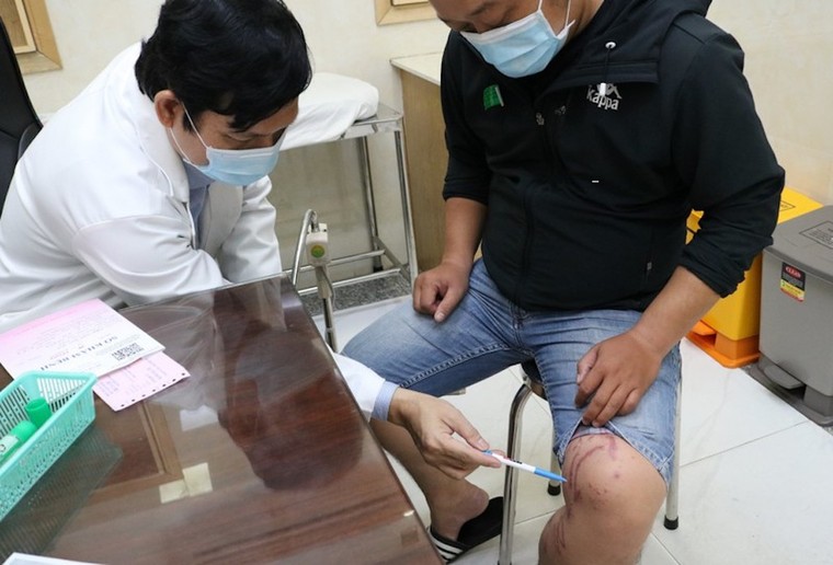 TP.HCM: Cảnh báo nguy cơ bỏng da, viêm da do kiến ba khoang trong mùa mưa ảnh 1