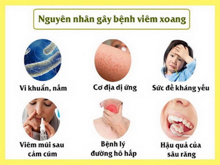 Thời tiết nắng nóng, phòng tránh bệnh viêm xoang như thế nào? ảnh 1